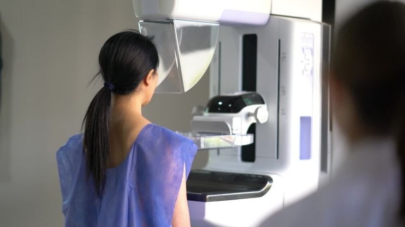 Μόνο η μαστογραφία βασική εξέταση για την πρόληψη του καρκίνου του μαστού